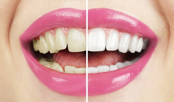 What Early Signs of Oral Cancer Should You Never Ignore Harlow?