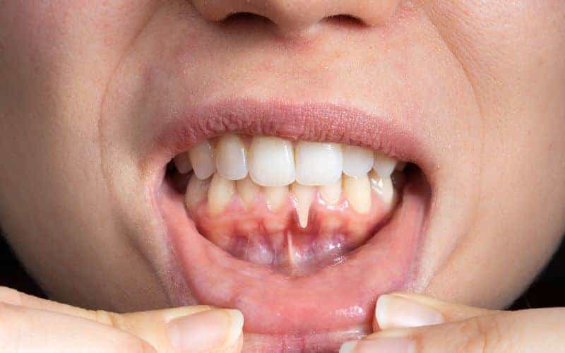 Final Thoughts: Building Lifelong Enamel Protection Habits Harlow