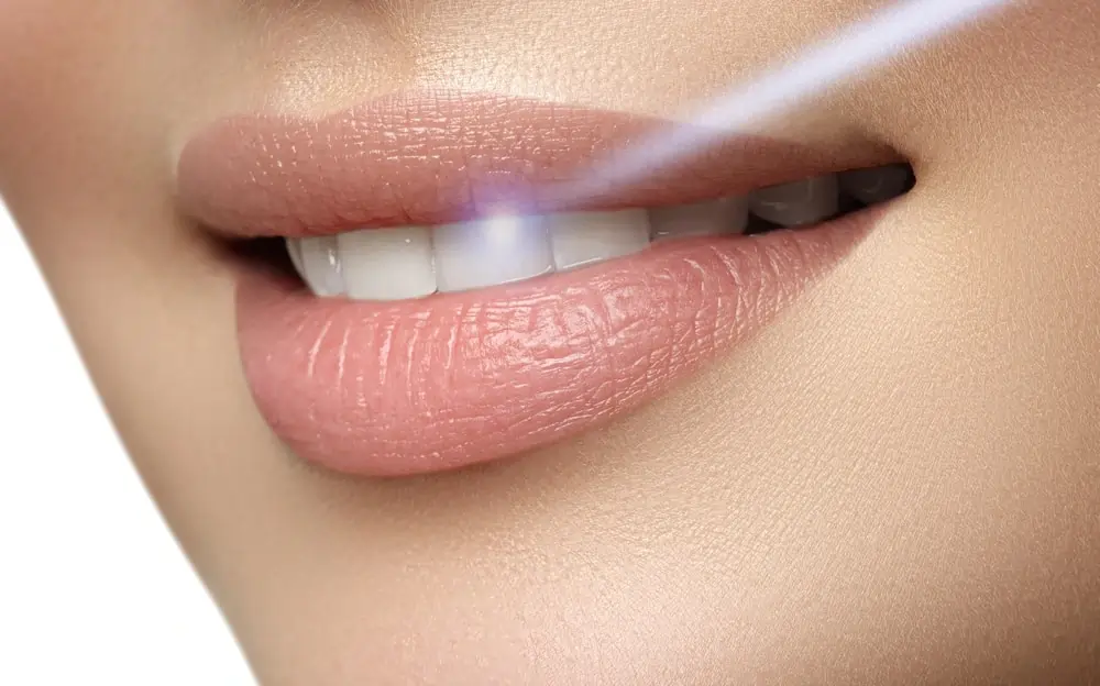 How Different Cultures Achieve Naturally Brighter Smiles Harlow
