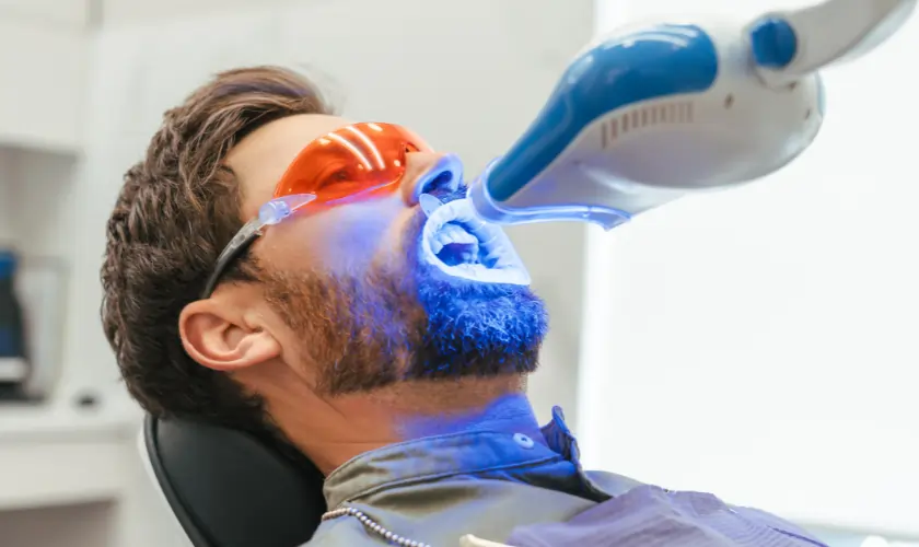 The Hidden Differences Between DIY and Professional Teeth Whitening Harlow