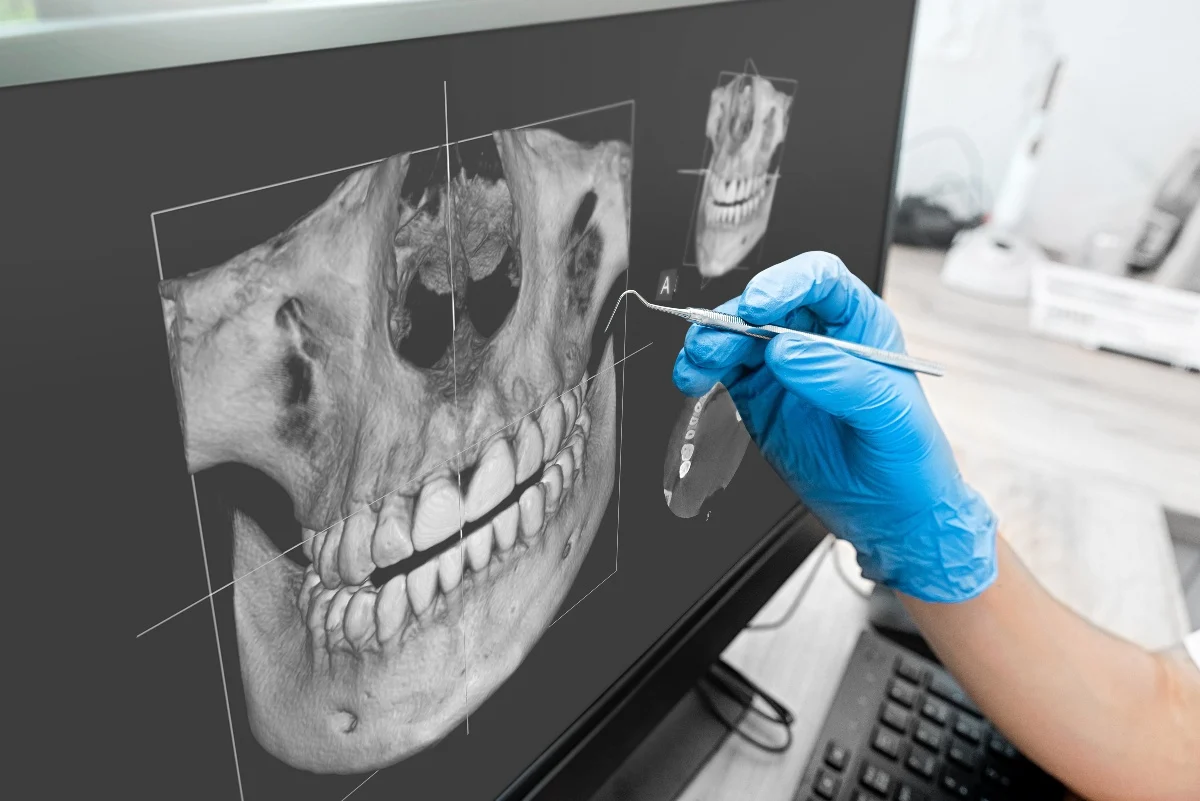 How Is AI Transforming Dental Treatment Planning Harlow?