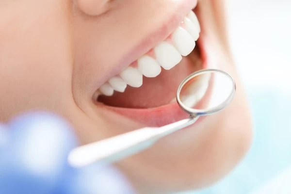 The Science Behind Natural Whitening: Myth vs Reality Harlow