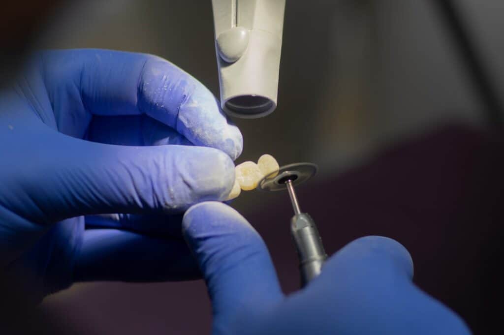 Customised Dental Solutions: Crowns, Aligners, and Implants Harlow